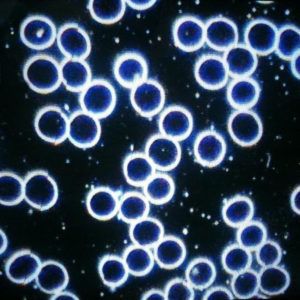 ON-Blog-Live-Cell-Microscopy-healthy-blood-cells